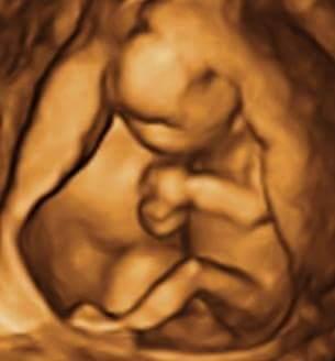 Prenatal Premiere 3d 4d Ultrasound 3126 S Higley Rd Ste 104